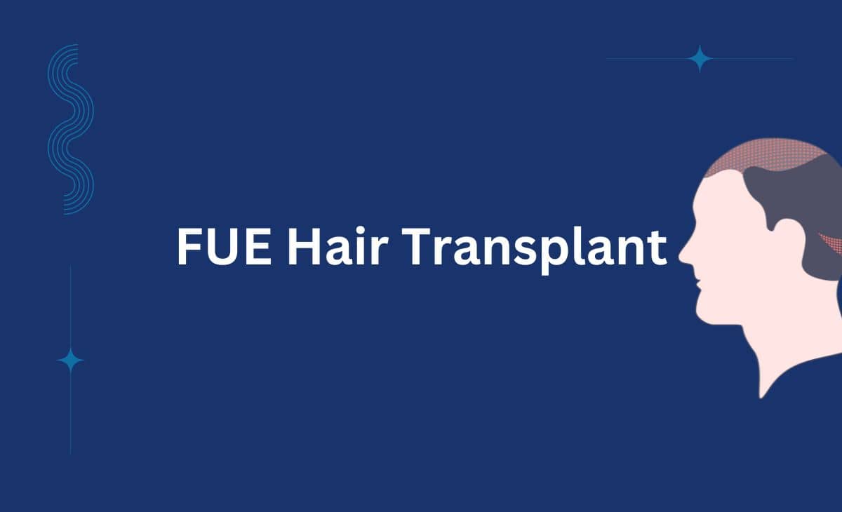 FUE Hair Transplant: What to Expect, Cost, and More