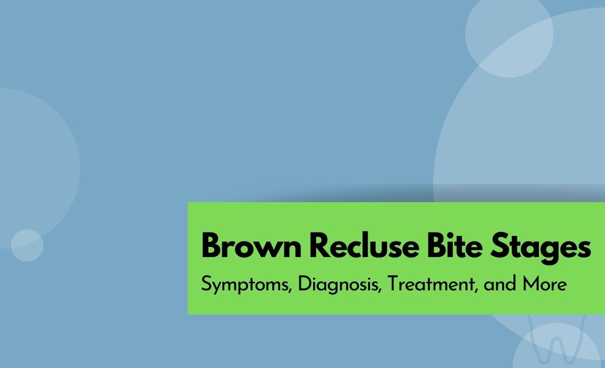 Brown Recluse Bite Stages Symptoms Diagnosis And Treatment Resurchify