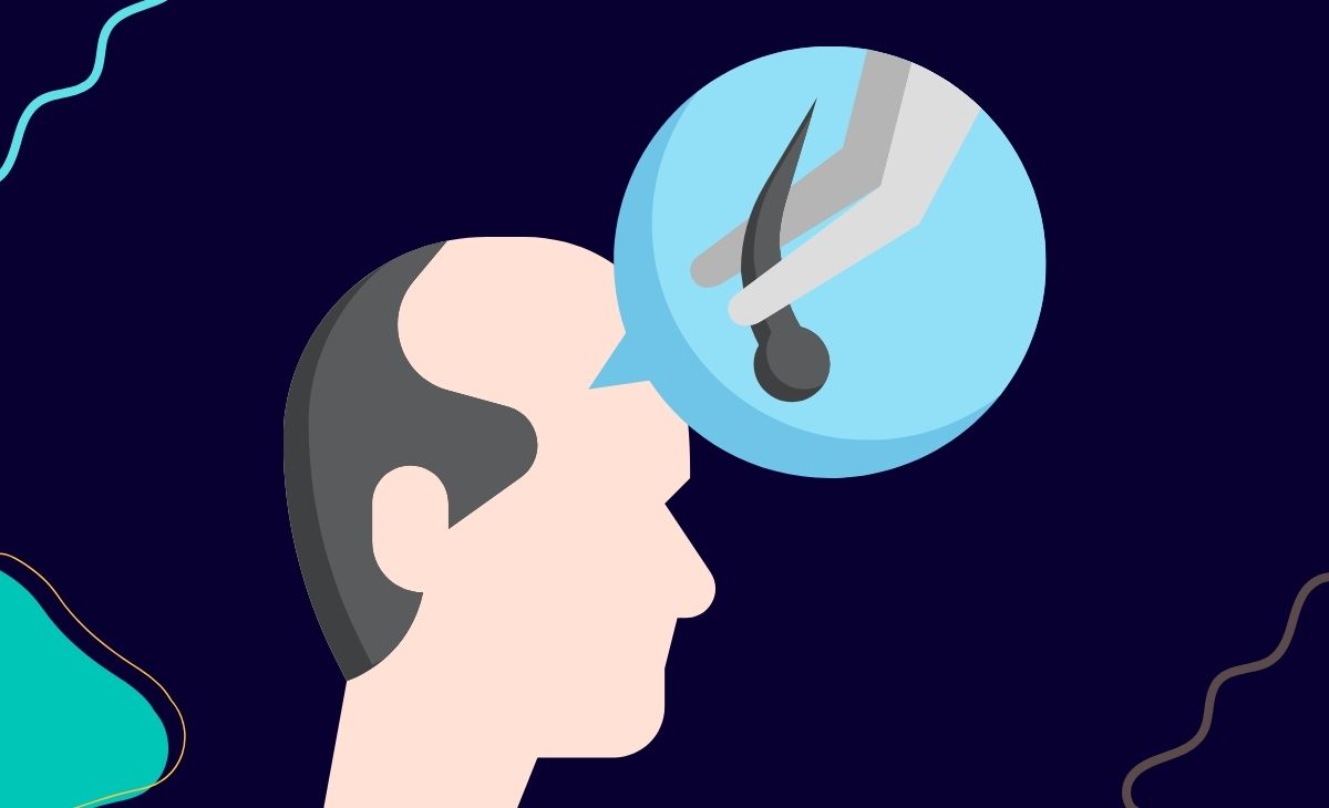 Hair Transplant: Cost of Treatment, Recovery, and More