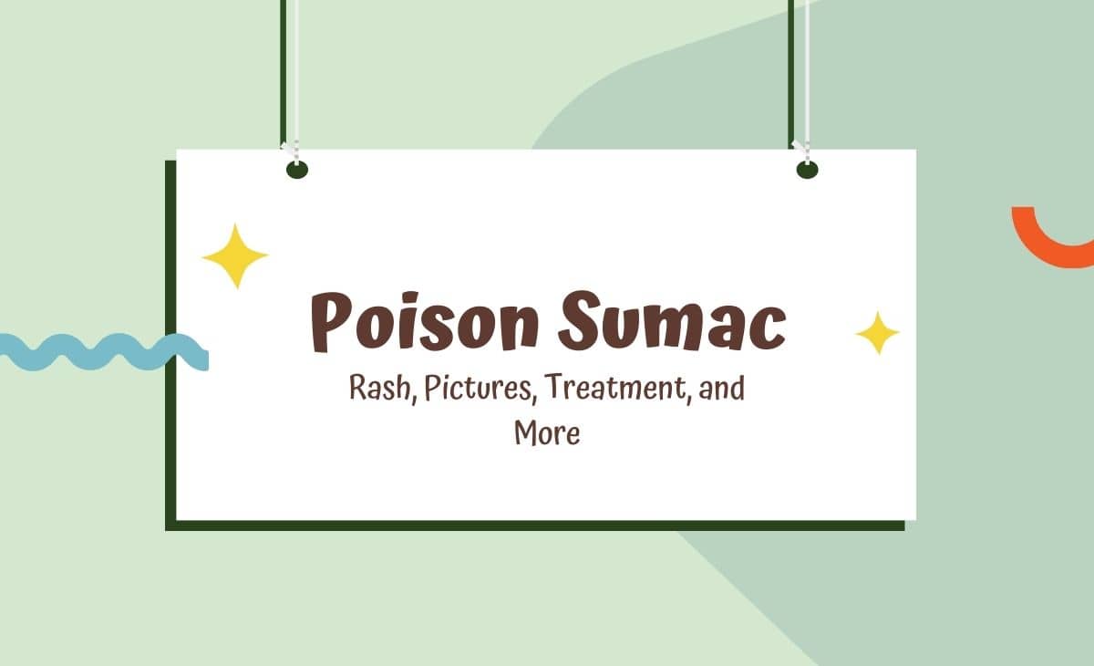 Poison Sumac Rash, Pictures, and Treatment Resurchify