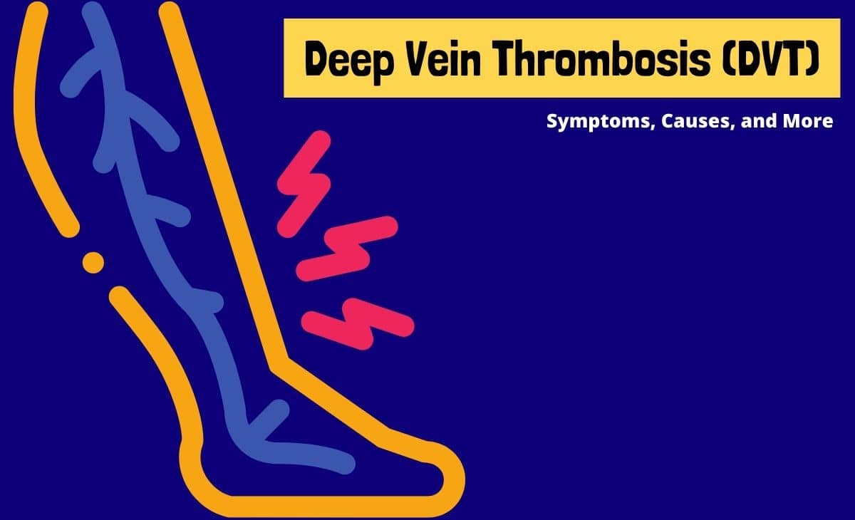 Deep Vein Thrombosis (DVT) Symptoms, Causes, and More Resurchify
