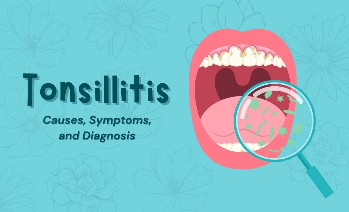 Tonsillitis Causes, Symptoms, and Diagnosis Resurchify