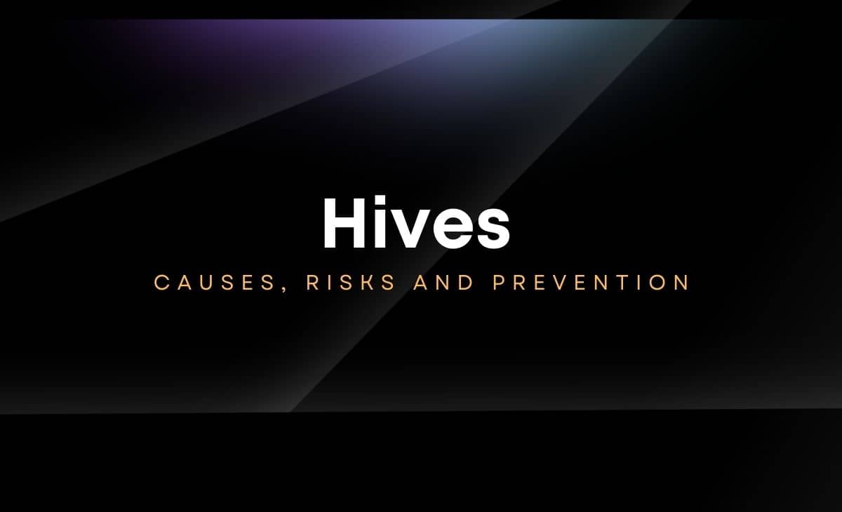 Hives: Causes, Risks and Prevention