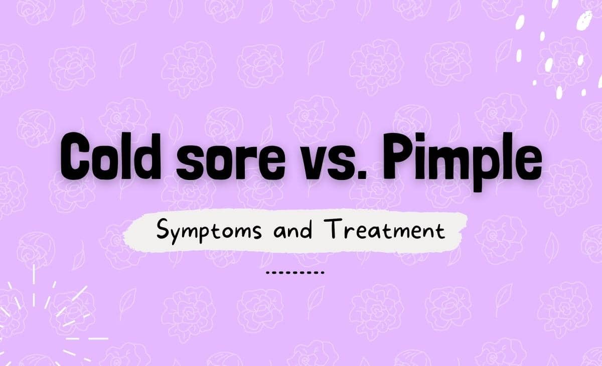 Cold Sore vs. Pimple Symptoms and Treatment Resurchify